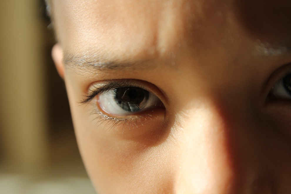 Sunlight hitting a child’s eye