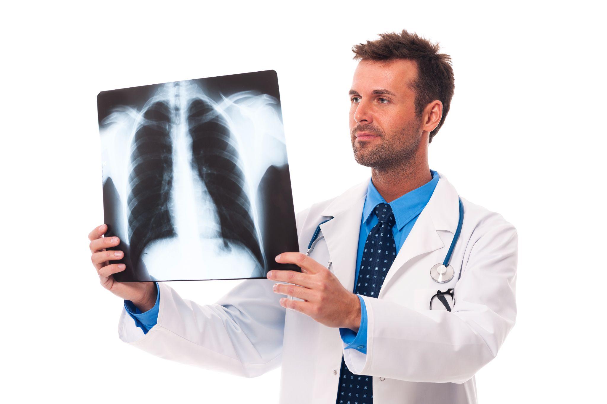 A doctor holding an X-ray of lungs