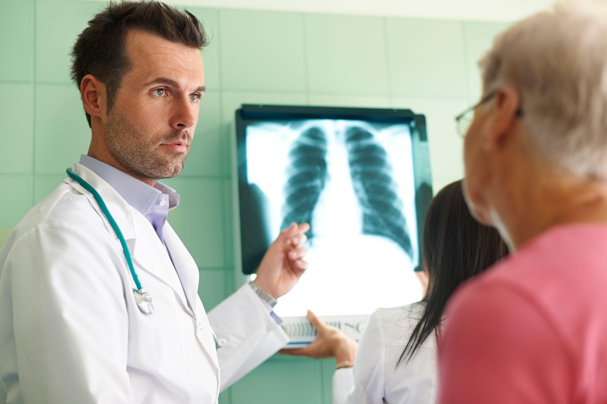 A doctor discussing an X-ray image of the lungs with a patient