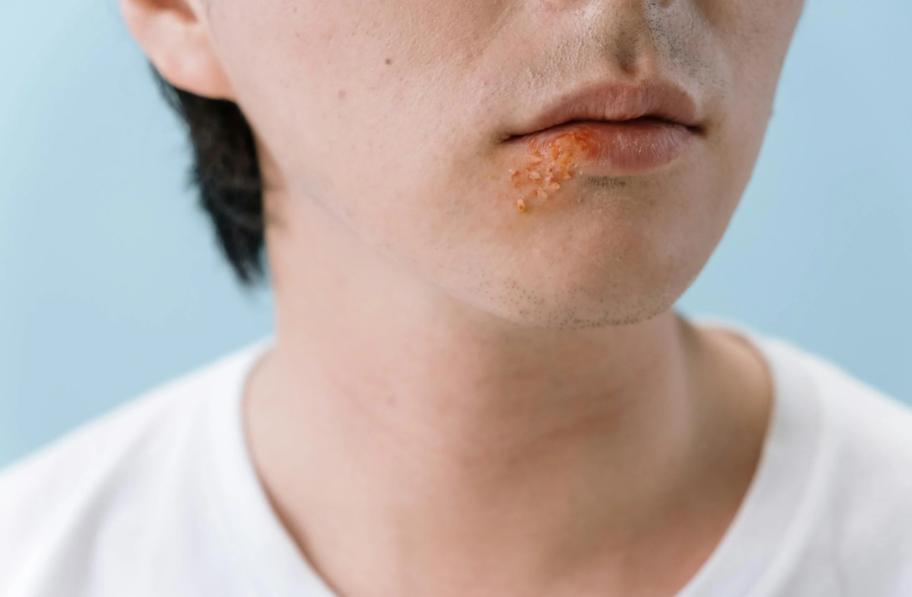A person with a skin infection in need of a legit doctor’s note for work.