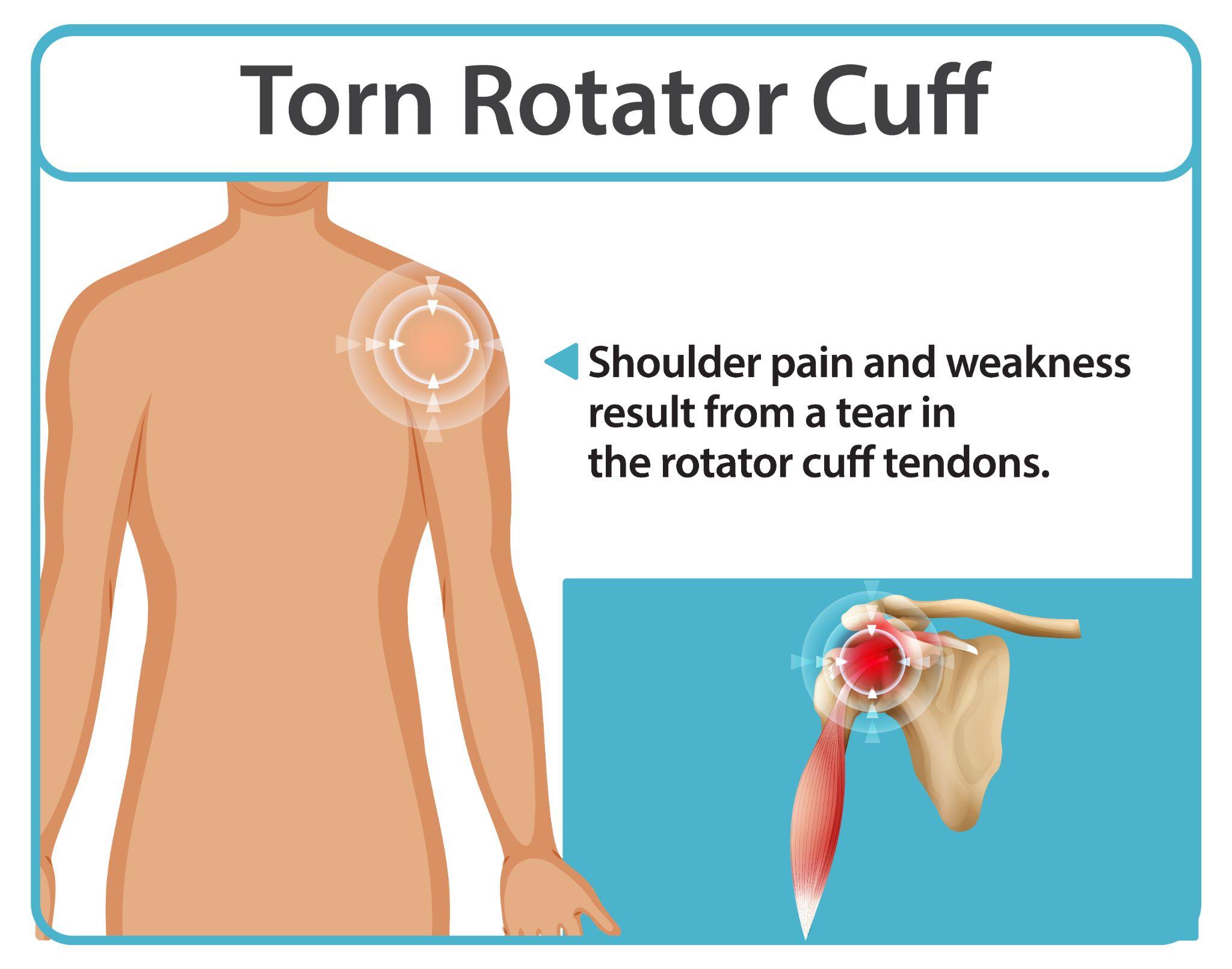 Infographic showing shoulder and rotator cuff injury