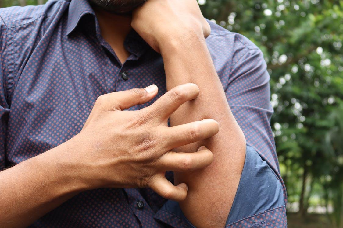 Person scratching their forearm due to skin irritation or an allergic reaction